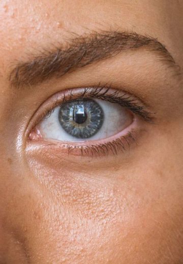 eyebrow transplant in nepal