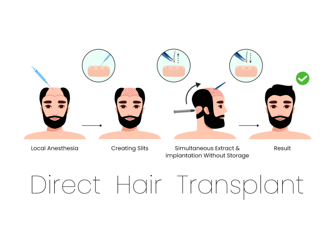 Direct Hair Transplant (DHT)