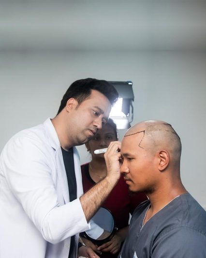 Globally Trusted Hair Transplant Expert